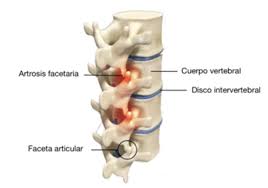 Ilustración médica de la columna vertebral