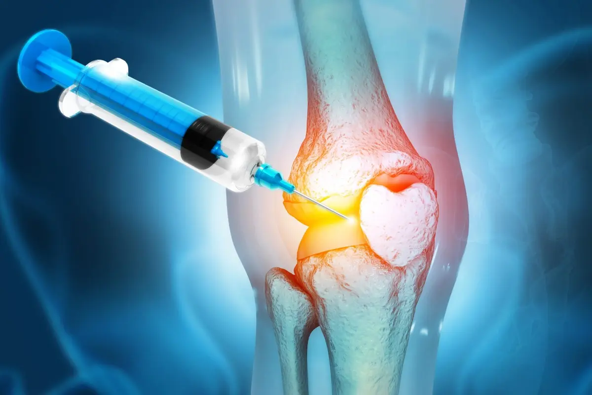 Infiltración guiada por imagen en la articulación de la rodilla